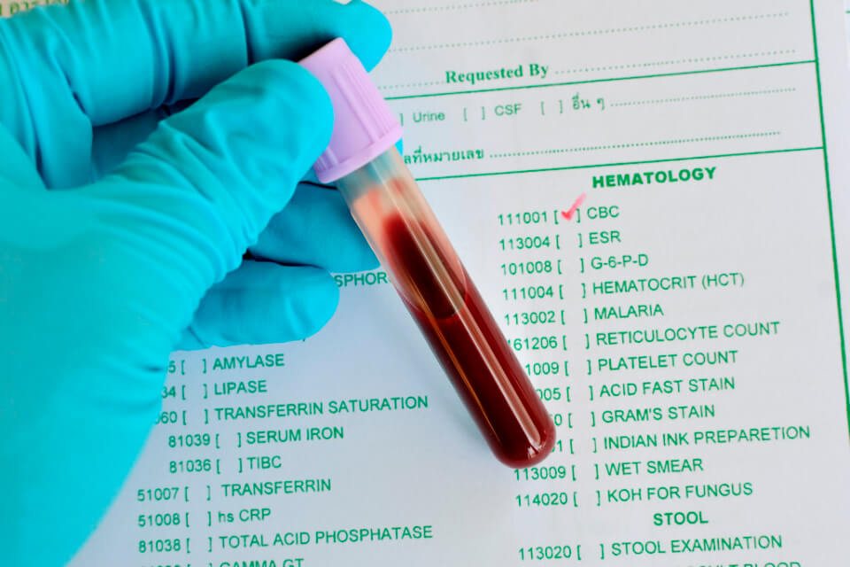 Общий анализ крови: расшифровка для взрослых и детей, правила подготовки