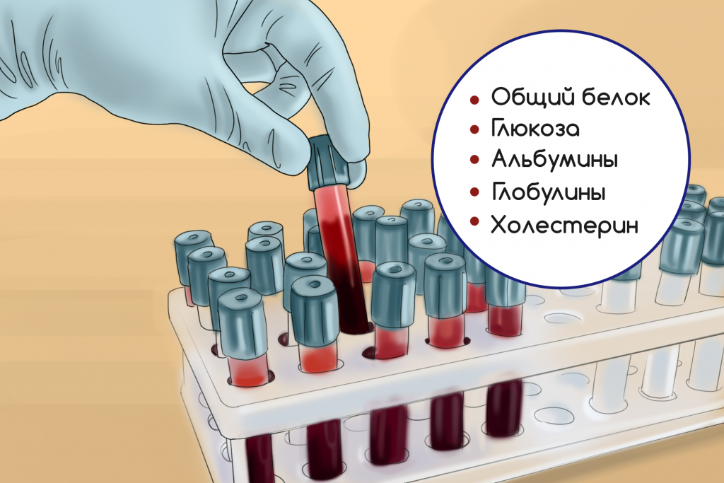 Биохимический анализ крови - 12 значимых показателй